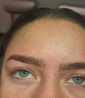 Brows