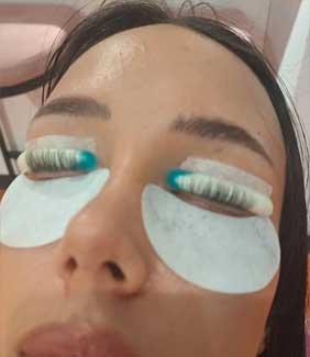 Eye