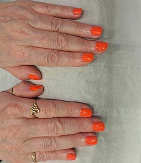Nail