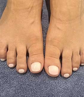 Nail
